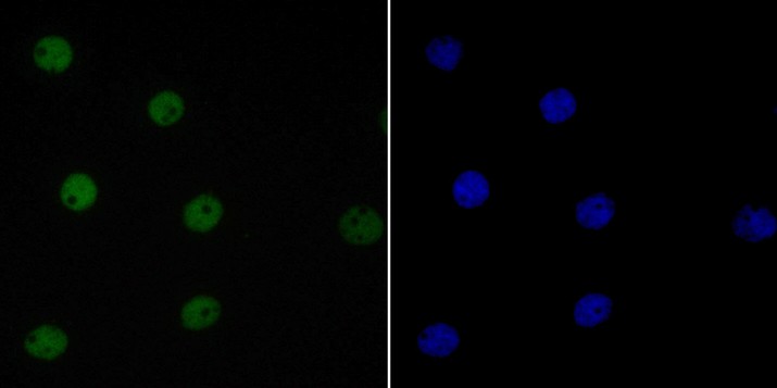 A431 cell; 4% Paraformaldehyde-fixed; Triton X-100 at room temperature for 20 min; Blocking buffer (normal goat serum) at 37°C for 20 min; Antibody incubation with (EWSR1/EWS) Monoclonal Antibody, Unconjugated (bsm-54677R) 1:50, 90 minutes at 37°C; followed by a conjugated Goat Anti-Rabbit IgG antibody at 37°C for 90 minutes, DAPI (blue) was used to stain the cell nuclei.