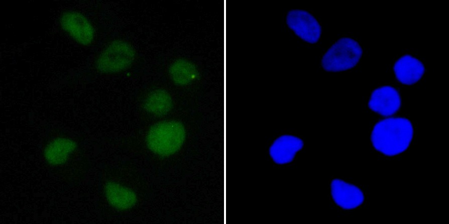 SK-BR-3 cell; 4% Paraformaldehyde-fixed; Triton X-100 at room temperature for 20 min; Blocking buffer (normal goat serum) at 37°C for 20 min; Antibody incubation with (EWSR1/EWS) Monoclonal Antibody, Unconjugated (bsm-54677R) 1:50, 90 minutes at 37°C; followed by a conjugated Goat Anti-Rabbit IgG antibody at 37°C for 90 minutes, DAPI (blue) was used to stain the cell nuclei.