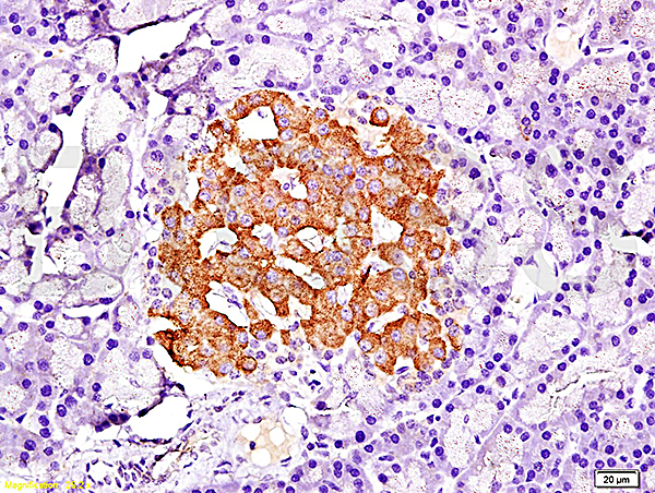 Formalin-fixed and paraffin embedded rat pancreas tissue labeled with Anti-PDX-1 Polyclonal Antibody, Unconjugated (bs-0923R) at 1:200, followed by conjugation to the secondary antibody and DAB staining