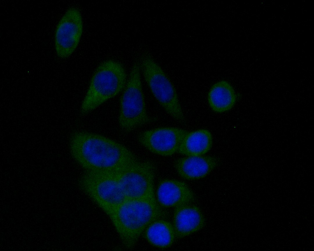SW620 cell; 4% Paraformaldehyde-fixed; Triton X-100 at room temperature for 20 min; Blocking buffer (normal goat serum) at 37°C for 20 min; Antibody incubation with (BCL2L12) Monoclonal Antibody, Unconjugated (bsm-54682R) 1:50, 90 minutes at 37°C; followed by a conjugated Goat Anti-Rabbit IgG antibody at 37°C for 90 minutes, DAPI (blue) was used to stain the cell nuclei.