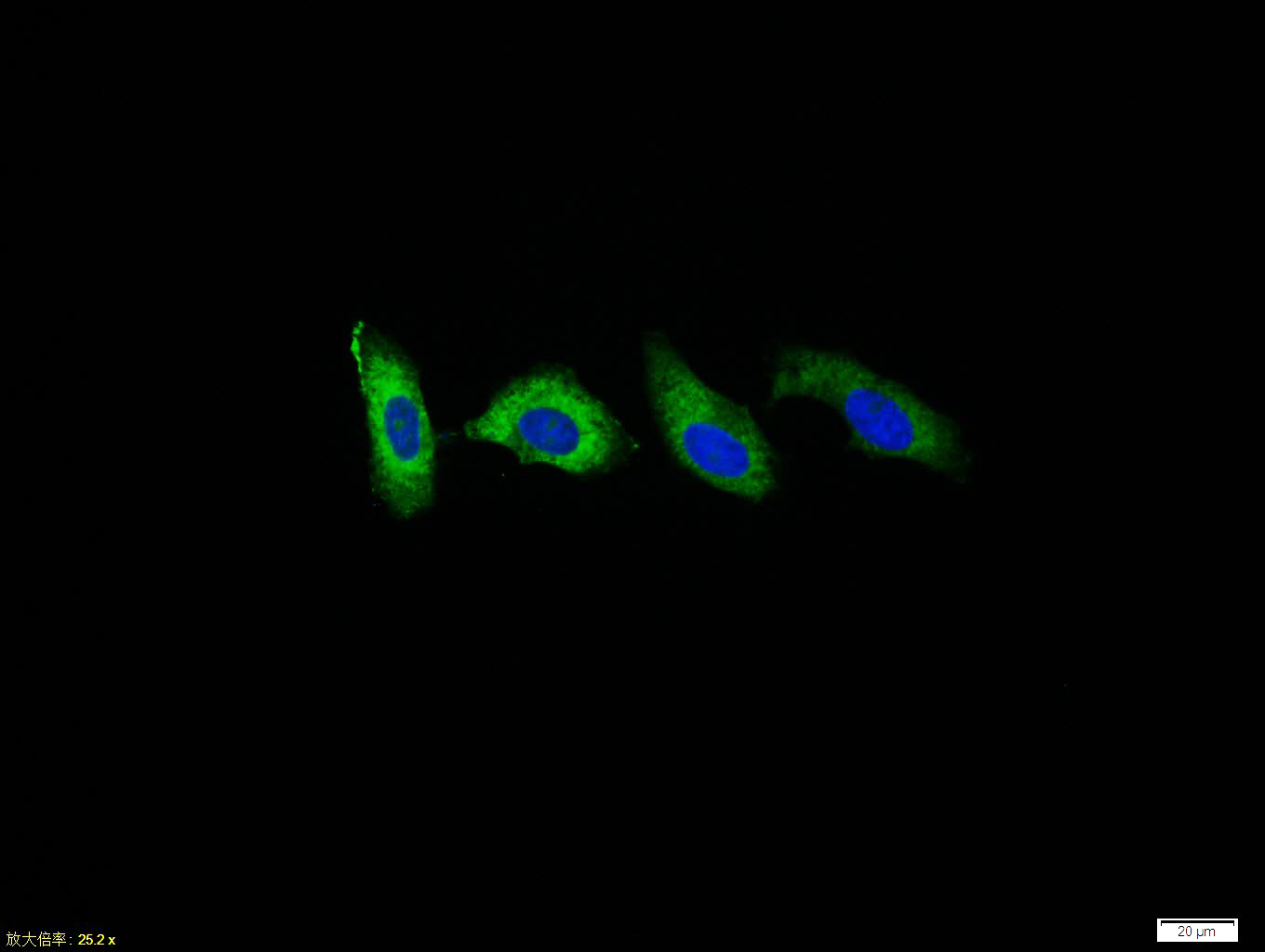 HepG2 cell; 4% Paraformaldehyde-fixed; Triton X-100 at room temperature for 20 min; Blocking buffer (normal goat serum, C-0005) at 37°C for 20 min; Antibody incubation with (LDL receptor) polyclonal Antibody, Unconjugated (bs-0705R) 1:100, 90 minutes at 37°C; followed by a conjugated Goat Anti-Rabbit IgG antibody at 37°C for 90 minutes, DAPI (blue, C02-04002) was used to stain the cell nuclei.