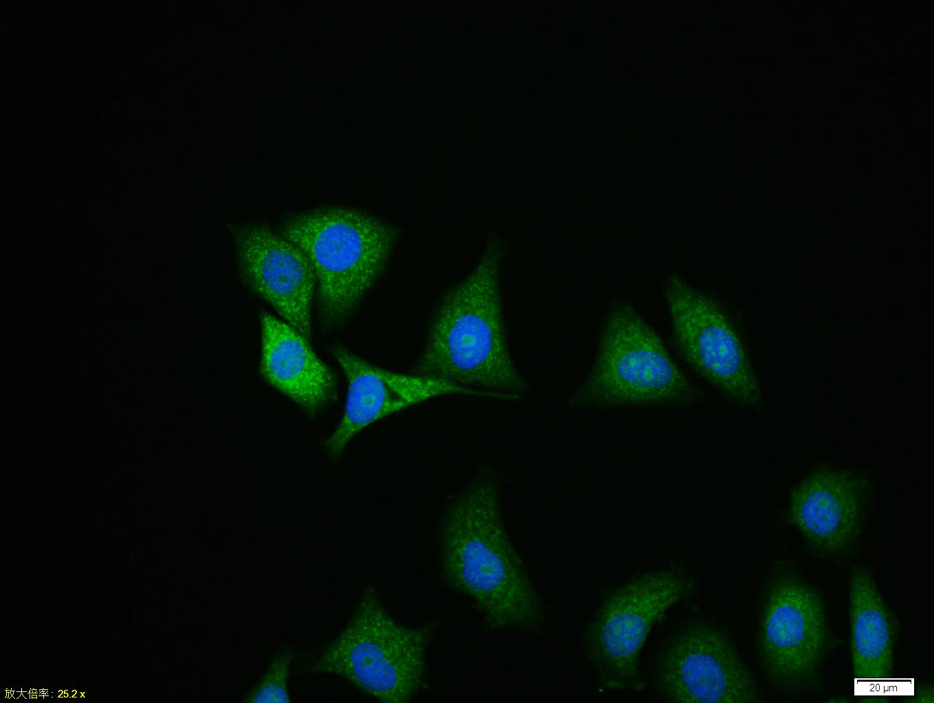 HepG2 cell; 4% Paraformaldehyde-fixed; Triton X-100 at room temperature for 20 min; Blocking buffer (normal goat serum, C-0005) at 37°C for 20 min; Antibody incubation with (Ubiquitin) polyclonal Antibody, Unconjugated (bs-1549R) 1:100, 90 minutes at 37°C; followed by a conjugated Goat Anti-Rabbit IgG antibody at 37°C for 90 minutes, DAPI (blue, C02-04002) was used to stain the cell nuclei.