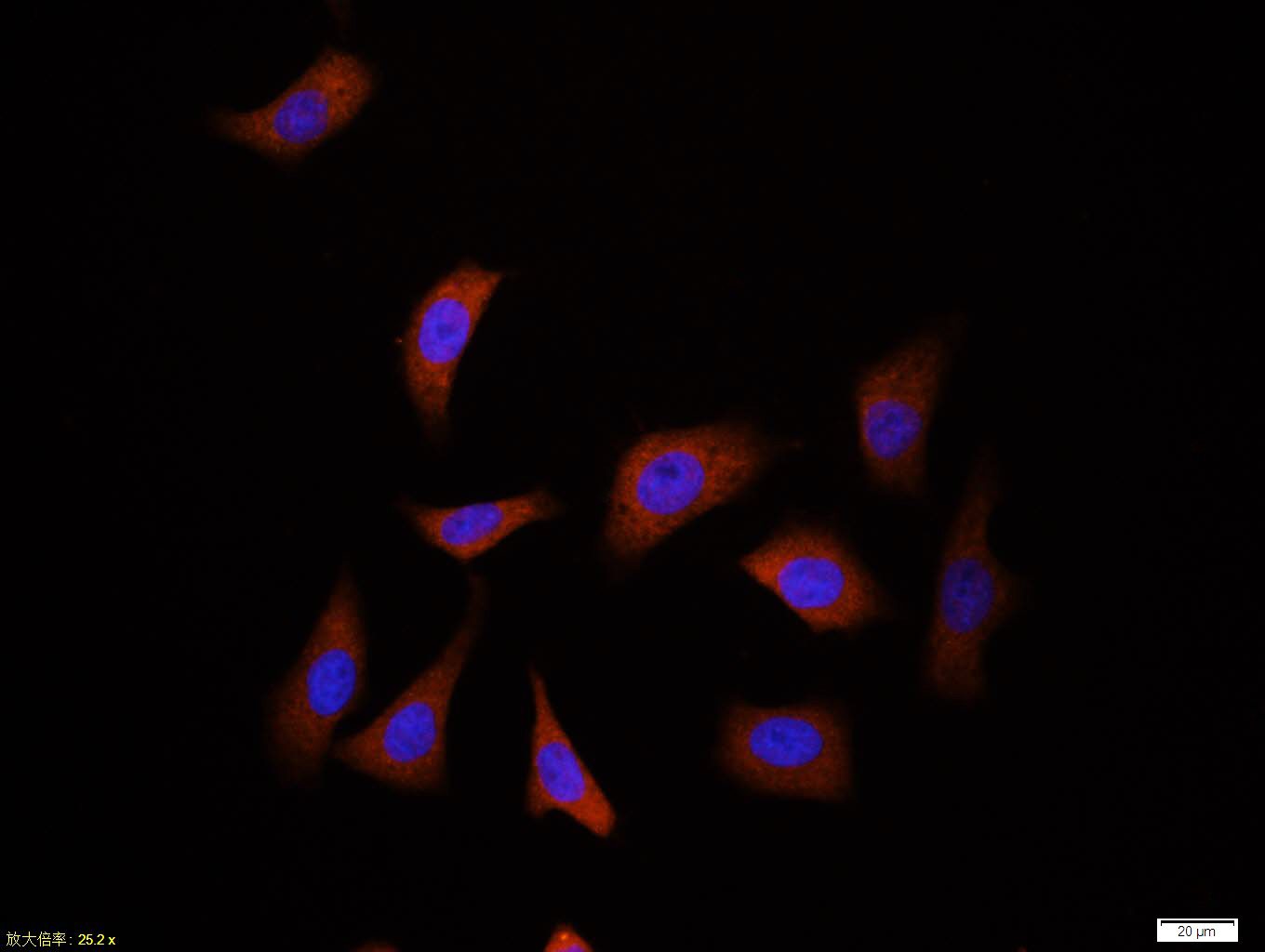 HepG2 cell; 4% Paraformaldehyde-fixed; Triton X-100 at room temperature for 20 min; Blocking buffer (normal goat serum, C-0005) at 37°C for 20 min; Antibody incubation with (Ubiquitin) monoclonol Antibody, Unconjugated (bsm-33307M) 1:100, 90 minutes at 37°C; followed by a conjugated Goat Anti-Mouse IgG antibody at 37°C for 90 minutes, DAPI (blue, C02-04002) was used to stain the cell nuclei.