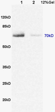 L1 rat brain lysates L2 rat heart lysates probed with Anti DENTT Polyclonal Antibody, Unconjugated (bs-7051R) at 1:200 in 4˚C. Followed by conjugation to secondary antibody (bs-0295G-HRP) at 1:3000 90min in 37˚C. Predicted band 76kD. Observed band size: 70kD