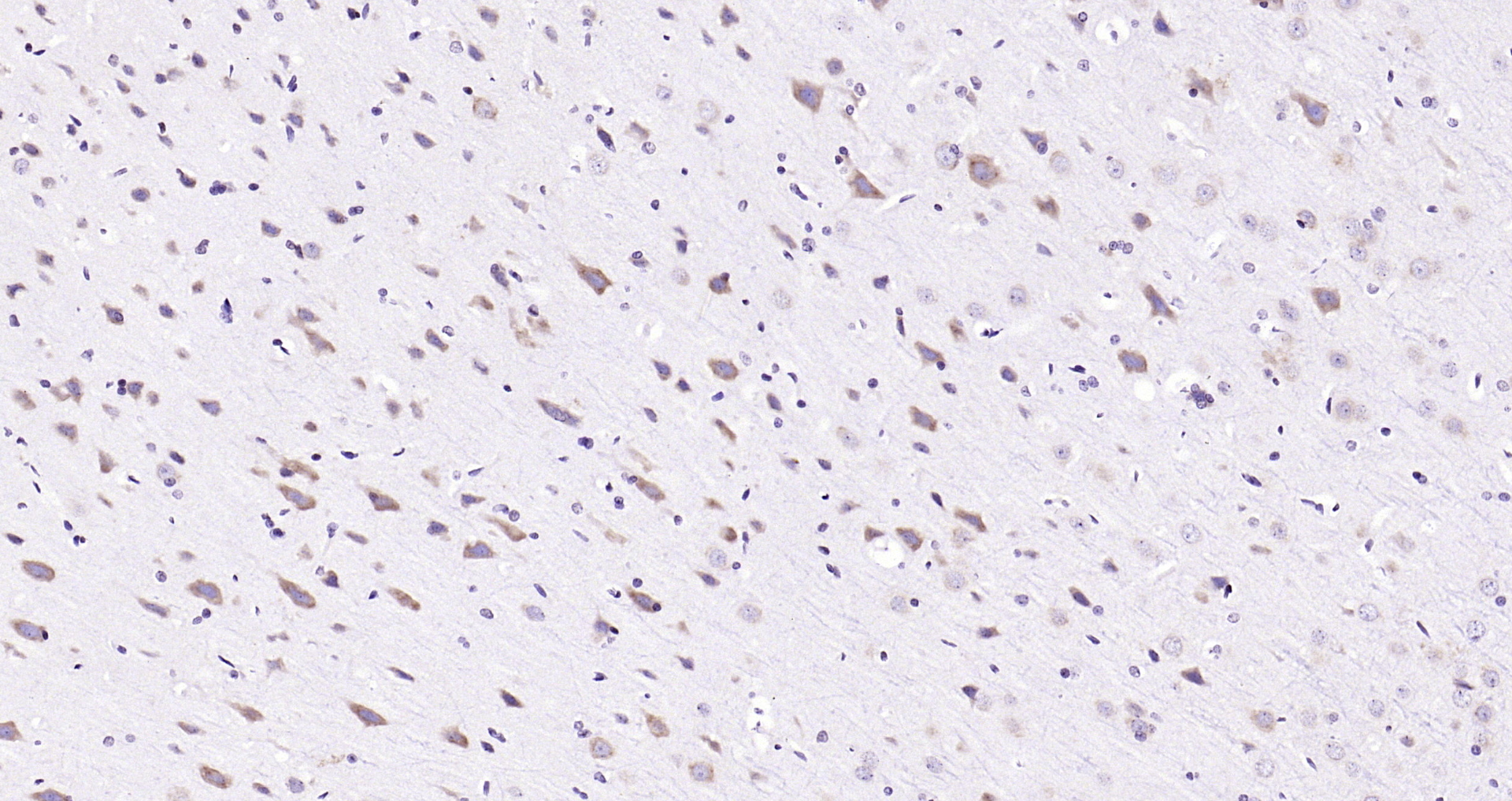Paraformaldehyde-fixed, paraffin embedded Rat brain; Antigen retrieval by boiling in sodium citrate buffer (pH6.0) for 15min; Block endogenous peroxidase by 3% hydrogen peroxide for 20 minutes; Blocking buffer (normal goat serum) at 37°C for 30min; Antibody incubation with ATF4/CREB-2 Polyclonal Antibody, Unconjugated (bs-1531R) at 1:200 overnight at 4°C, DAB staining.