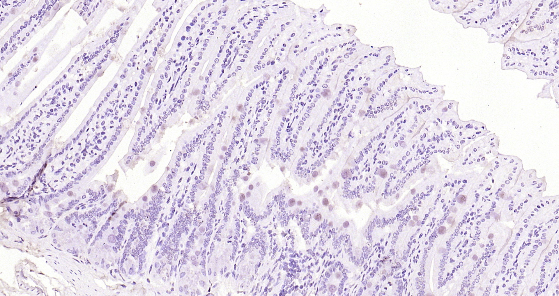 Paraformaldehyde-fixed, paraffin embedded Mouse intestine; Antigen retrieval by boiling in sodium citrate buffer (pH6.0) for 15min; Block endogenous peroxidase by 3% hydrogen peroxide for 20 minutes; Blocking buffer (normal goat serum) at 37°C for 30min; Antibody incubation with ApoA4 Polyclonal Antibody, Unconjugated (bs-2688R) at 1:200 overnight at 4°C, DAB staining.