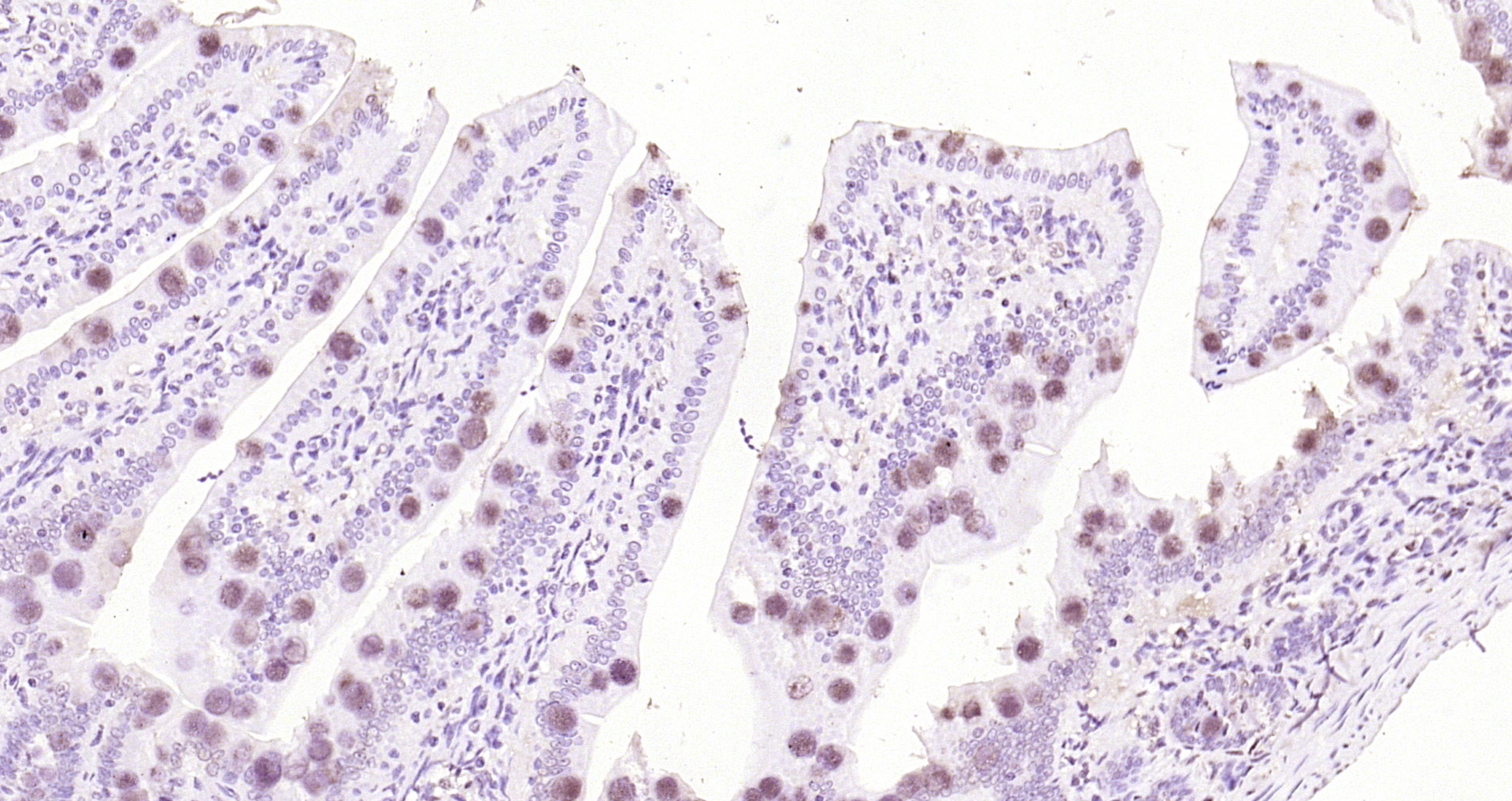 Paraformaldehyde-fixed, paraffin embedded Rat intestine; Antigen retrieval by boiling in sodium citrate buffer (pH6.0) for 15min; Block endogenous peroxidase by 3% hydrogen peroxide for 20 minutes; Blocking buffer (normal goat serum) at 37°C for 30min; Antibody incubation with ApoA4 Polyclonal Antibody, Unconjugated (bs-2688R) at 1:200 overnight at 4°C, DAB staining.