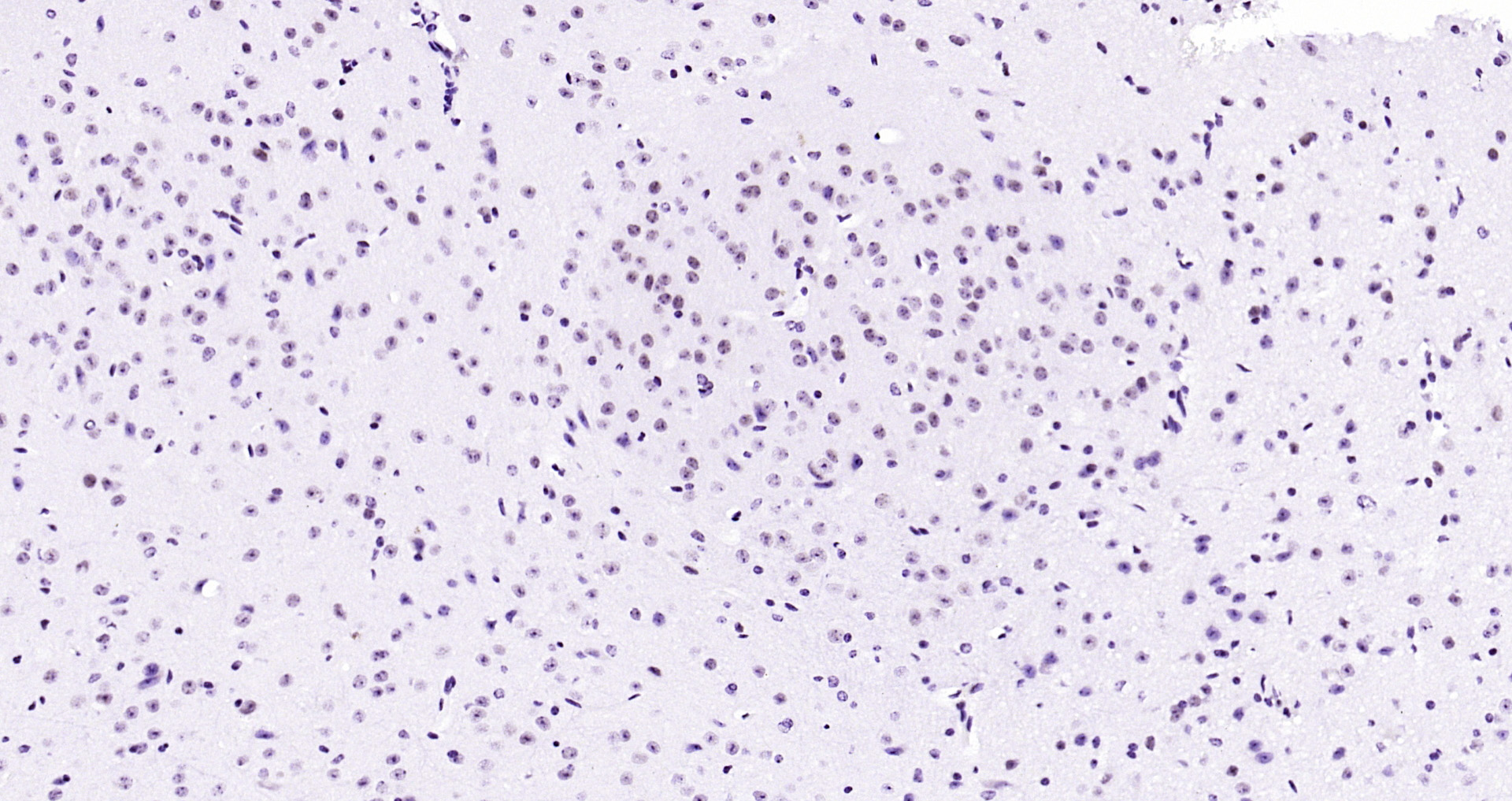 Paraformaldehyde-fixed, paraffin embedded Mouse brain; Antigen retrieval by boiling in sodium citrate buffer (pH6.0) for 15min; Block endogenous peroxidase by 3% hydrogen peroxide for 20 minutes; Blocking buffer (normal goat serum) at 37°C for 30min; Antibody incubation with API5 Polyclonal Antibody, Unconjugated (bs-1252R) at 1:200 overnight at 4°C, DAB staining.
