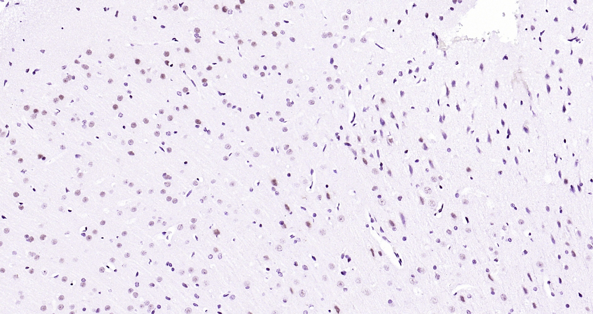 Paraformaldehyde-fixed, paraffin embedded Rat brain; Antigen retrieval by boiling in sodium citrate buffer (pH6.0) for 15min; Block endogenous peroxidase by 3% hydrogen peroxide for 20 minutes; Blocking buffer (normal goat serum) at 37°C for 30min; Antibody incubation with API5 Polyclonal Antibody, Unconjugated (bs-1252R) at 1:200 overnight at 4°C, DAB staining.
