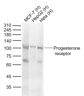 Lane 1: Human MCF-7 cell lysates; Lane 2: Human HepG2 cell lysates; Lane 3: Human Hela cell lysates probed with Progesterone Receptor Polyclonal Antibody, Unconjugated (bs-0111R) at 1:500 dilution and 4˚C overnight incubation. Followed by conjugated secondary antibody incubation at 1:20000 for 60 min at 37˚C.