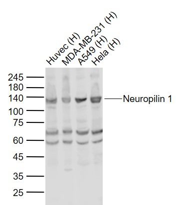 Lane 1: Human Huvec cell lysates; Lane 2: Human MDA-MB-231 cell lysates; Lane 3: Human A549 cell lysates; Lane 4: Human Hela cell lysates probed with Neuropilin 1 Polyclonal Antibody, Unconjugated (bs-0693R) at 1:1000 dilution and 4˚C overnight incubation. Followed by conjugated secondary antibody incubation at 1:20000 for 60 min at 37˚C.