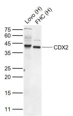 Lane 1: Human Lovo cell lysates; Lane 2: Human FHC cell lysates probed with CDX2 Polyclonal Antibody, Unconjugated (bs-1620R) at 1:1000 dilution and 4˚C overnight incubation. Followed by conjugated secondary antibody incubation at 1:20000 for 60 min at 37˚C.