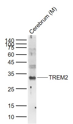 Lane 1: Mouse Cerebrum lysates probed with TREM2 Polyclonal Antibody, Unconjugated (bs-2737R) at 1:1000 dilution and 4˚C overnight incubation. Followed by conjugated secondary antibody incubation at 1:20000 for 60 min at 37˚C.