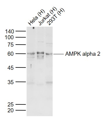 Lane 1: Human Hela cell lysates; Lane 2: Human Jurkat cell lysates; Lane 3: Human 293T cell lysates probed with AMPK alpha 2 Polyclonal Antibody, Unconjugated (bs-2771R) at 1:1000 dilution and 4˚C overnight incubation. Followed by conjugated secondary antibody incubation at 1:20000 for 60 min at 37˚C.