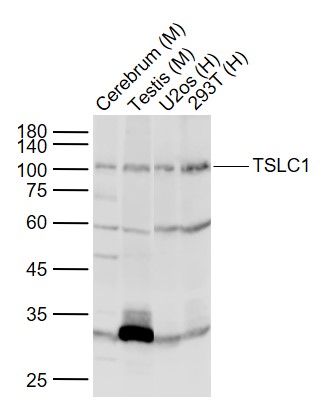 Lane 1: Mouse Cerebrum lysates; Lane 2: Mouse Testis lysates; Lane 3: Human U2os cell lysates; Lane 4: Human 293T cell lysates probed with TSLC1 Polyclonal Antibody, Unconjugated (bs-6026R) at 1:1000 dilution and 4˚C overnight incubation. Followed by conjugated secondary antibody incubation at 1:20000 for 60 min at 37˚C.