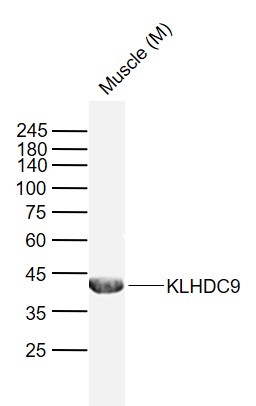 Lane 1: Mouse Muscle lysates probed with KLHDC9 Polyclonal Antibody, Unconjugated (bs-8359R) at 1:1000 dilution and 4˚C overnight incubation. Followed by conjugated secondary antibody incubation at 1:20000 for 60 min at 37˚C.