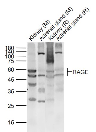 Lane 1: Mouse Kidney lysates; Lane 2: Mouse Adrenal gland lysates; Lane 3: Rat Kidney lysates; Lane 4: Rat Adrenal gland lysates probed with RAGE Polyclonal Antibody, Unconjugated (bs-0177R) at 1:1000 dilution and 4˚C overnight incubation. Followed by conjugated secondary antibody incubation at 1:20000 for 60 min at 37˚C.