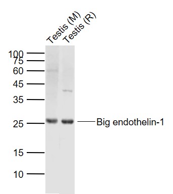Lane 1: Mouse Testis lysates; Lane 2: Rat Testis lysates probed with Preproendothelin 1 Polyclonal Antibody, Unconjugated (bs-0188R) at 1:1000 dilution and 4˚C overnight incubation. Followed by conjugated secondary antibody incubation at 1:20000 for 60 min at 37˚C.