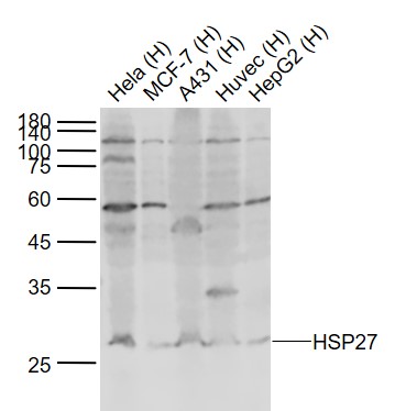 Lane 1: Human Hela cell lysates; Lane 2: Human MCF-7 cell lysates; Lane 3: Human A431 cell lysates; Lane 4: Human Huvec cell lysates ; Lane 5: Human HepG2 cell lysates probed with HSP27 Polyclonal Antibody, Unconjugated (bs-0730R) at 1:1000 dilution and 4˚C overnight incubation. Followed by conjugated secondary antibody incubation at 1:20000 for 60 min at 37˚C.