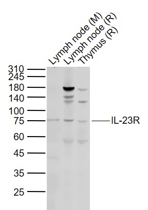 Lane 1: Mouse Lymph node lysates; Lane 2: Rat Lymph node lysates; Lane 3: Rat Thymus lysates probed with IL-23R Polyclonal Antibody, Unconjugated (bs-1460R) at 1:1000 dilution and 4˚C overnight incubation. Followed by conjugated secondary antibody incubation at 1:20000 for 60 min at 37˚C.