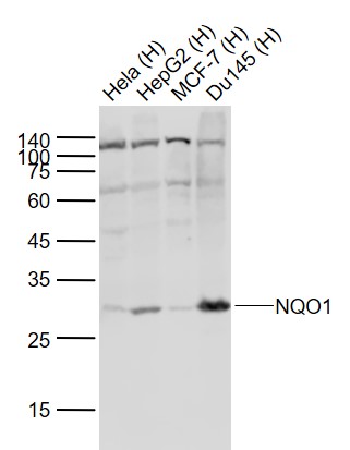 Lane 1: Human Hela cell lysates; Lane 2: Human HepG2 cell lysates; Lane 3: Human MCF-7 cell lysates; Lane 4: Human Du145 cell lysates probed with NQO1 Polyclonal Antibody, Unconjugated (bs-2184R) at 1:1000 dilution and 4˚C overnight incubation. Followed by conjugated secondary antibody incubation at 1:20000 for 60 min at 37˚C.