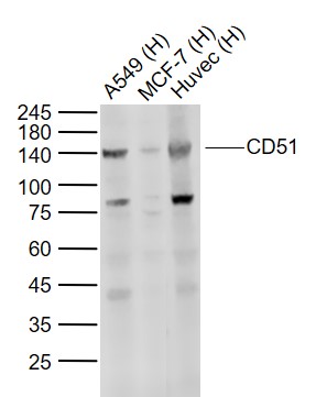 Lane 1: Human A549 cell lysates; Lane 2: Human MCF-7 cell lysates; Lane 3: Human Huvec cell lysates probed with Integrin alpha V\/CD51 Polyclonal Antibody, Unconjugated (bs-2250R) at 1:1000 dilution and 4˚C overnight incubation. Followed by conjugated secondary antibody incubation at 1:20000 for 60 min at 37˚C.
