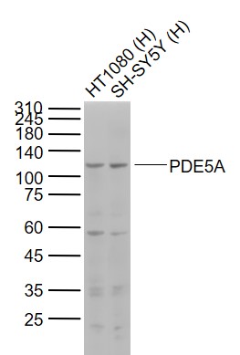 Lane 1: Human HT1080 cell lysates; Lane 2: Human SH-SY5Y cell lysates probed with PDE5A Polyclonal Antibody, Unconjugated (bs-2349R) at 1:1000 dilution and 4˚C overnight incubation. Followed by conjugated secondary antibody incubation at 1:20000 for 60 min at 37˚C.