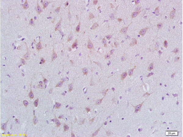 Formalin-fixed and paraffin embedded rat brain labeled with Rabbit Anti STMN2/SCG10 Polyclonal Antibody, Unconjugated (bs-3753R) at 1:200 followed by conjugation to the secondary antibody and DAB staining