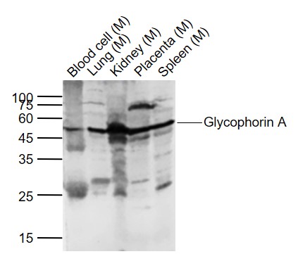 Lane 1: Mouse Blood cell lysates; Lane 2: Mouse Lung lysates; Lane 3: Mouse Kidney lysates; Lane 4: Mouse Placenta lysates ; Lane 5: Mouse Spleen lysates probed with Glycophorin A Polyclonal Antibody, Unconjugated (bs-2575R) at 1:1000 dilution and 4˚C overnight incubation. Followed by conjugated secondary antibody incubation at 1:20000 for 60 min at 37˚C.