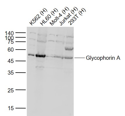 Lane 1: Human K562 cell lysates; Lane 2: Human HL60 cell lysates; Lane 3: Human Molt-4 cell lysates; Lane 4: Human Jurkat cell lysates ; Lane 5: Human 293T cell lysates probed with Glycophorin A Polyclonal Antibody, Unconjugated (bs-2575R) at 1:1000 dilution and 4˚C overnight incubation. Followed by conjugated secondary antibody incubation at 1:20000 for 60 min at 37˚C.
