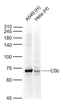 Lane 1: Human A549 cell lysates; Lane 2: Human Hela cell lysates probed with C5b Polyclonal Antibody, Unconjugated (bs-2673R) at 1:1000 dilution and 4˚C overnight incubation. Followed by conjugated secondary antibody incubation at 1:20000 for 60 min at 37˚C.
