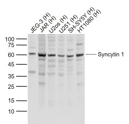 Lane 1: Human JEG-3 cell lysates; Lane 2: Human JAR cell lysates; Lane 3: Human U2os cell lysates; Lane 4: Human U251 cell lysates ; Lane 5: Human SH-SY5Y cell lysates ; Lane 6: Human HT1080 cell lysates probed with Syncytin 1 Polyclonal Antibody, Unconjugated (bs-2962R) at 1:1000 dilution and 4˚C overnight incubation. Followed by conjugated secondary antibody incubation at 1:20000 for 60 min at 37˚C.