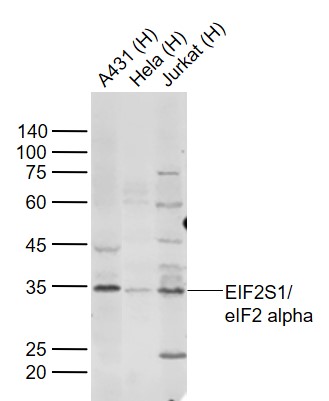 Lane 1: Human A431 cell lysates; Lane 2: Human Hela cell lysates; Lane 3: Human Jurkat cell lysates probed with eIF2 alpha Polyclonal Antibody, Unconjugated (bs-3613R) at 1:1000 dilution and 4˚C overnight incubation. Followed by conjugated secondary antibody incubation at 1:20000 for 60 min at 37˚C.
