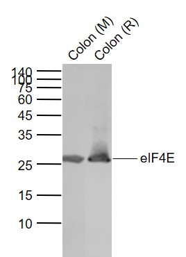 Lane 1: Mouse Colon lysates; Lane 2: Rat Colon lysates probed with eIF4E Polyclonal Antibody, Unconjugated (bs-4979R) at 1:1000 dilution and 4˚C overnight incubation. Followed by conjugated secondary antibody incubation at 1:20000 for 60 min at 37˚C.