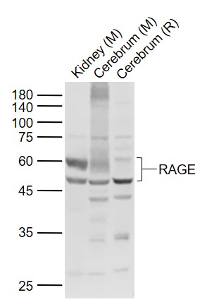 Lane 1: Mouse Kidney lysates; Lane 2: Mouse Cerebrum lysates; Lane 3: Rat Cerebrum lysates probed with AGER/RAGE Polyclonal Antibody, Unconjugated (bs-4999R) at 1:1000 dilution and 4˚C overnight incubation. Followed by conjugated secondary antibody incubation at 1:20000 for 60 min at 37˚C.
