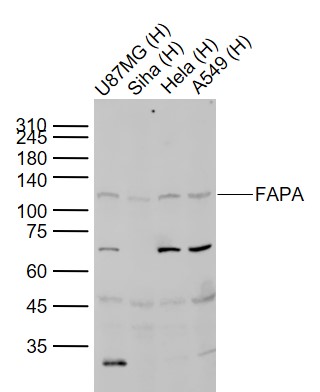 Lane 1: Human U87MG cell lysates; Lane 2: Human Siha cell lysates; Lane 3: Human Hela cell lysates; Lane 4: Human A549 cell lysates probed with FAPA Polyclonal Antibody, Unconjugated (bs-5758R) at 1:1000 dilution and 4˚C overnight incubation. Followed by conjugated secondary antibody incubation at 1:20000 for 60 min at 37˚C.