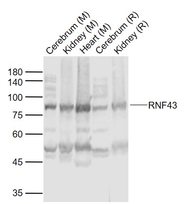 Lane 1: Mouse Cerebrum lysates; Lane 2: Mouse Kidney lysates; Lane 3: Mouse Heart lysates; Lane 4: Rat Cerebrum lysates ; Lane 5: Rat Kidney lysates probed with RNF43 Polyclonal Antibody, Unconjugated (bs-7007R) at 1:1000 dilution and 4˚C overnight incubation. Followed by conjugated secondary antibody incubation at 1:20000 for 60 min at 37˚C.
