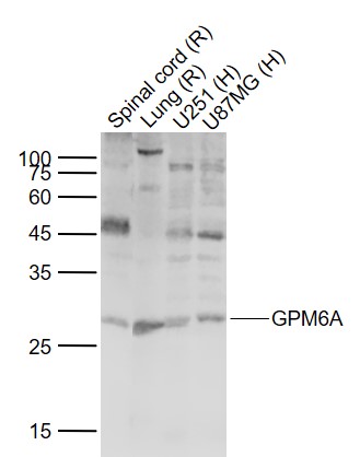 Lane 1: Rat Spinal cord lysates; Lane 2: Rat Lung lysates; Lane 3: Human U251 cell lysates; Lane 4: Human U87MG cell lysates probed with GPM6A Polyclonal Antibody, Unconjugated (bs-10757R) at 1:1000 dilution and 4˚C overnight incubation. Followed by conjugated secondary antibody incubation at 1:20000 for 60 min at 37˚C.