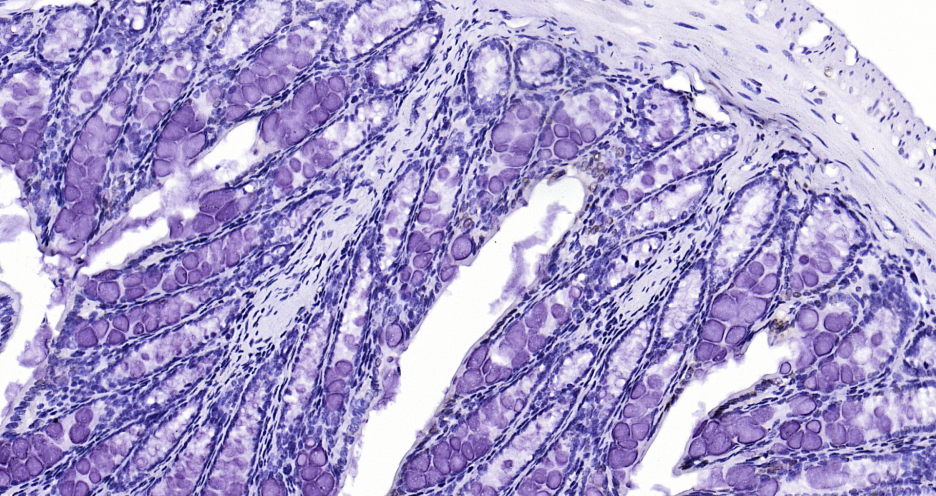 Paraformaldehyde-fixed, paraffin embedded Mouse colon; Antigen retrieval by boiling in sodium citrate buffer (pH6.0) for 15min; Block endogenous peroxidase by 3% hydrogen peroxide for 20 minutes; Blocking buffer (normal goat serum) at 37°C for 30min; Antibody incubation with CIDEC Polyclonal Antibody, Unconjugated (bs-6796R) at 1:200 overnight at 4°C, DAB staining.