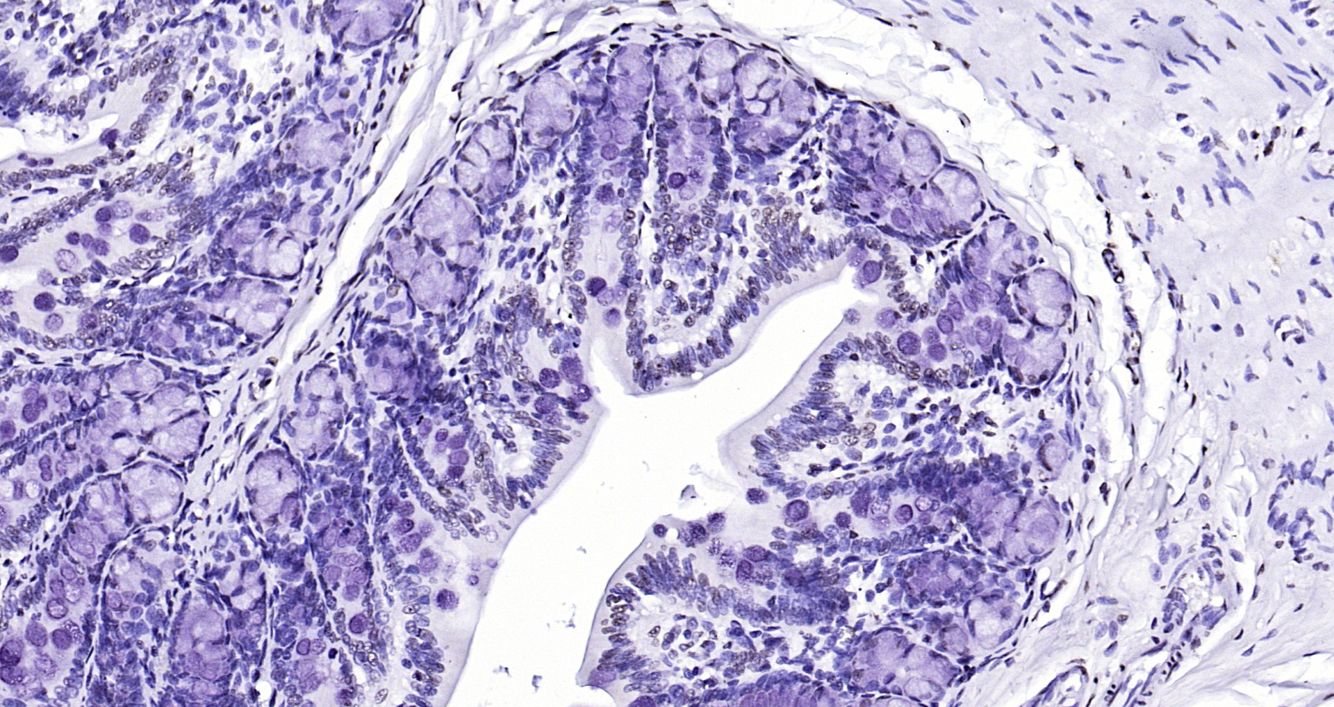Paraformaldehyde-fixed, paraffin embedded Rat colon; Antigen retrieval by boiling in sodium citrate buffer (pH6.0) for 15min; Block endogenous peroxidase by 3% hydrogen peroxide for 20 minutes; Blocking buffer (normal goat serum) at 37°C for 30min; Antibody incubation with CIDEC Polyclonal Antibody, Unconjugated (bs-6796R) at 1:200 overnight at 4°C, DAB staining.