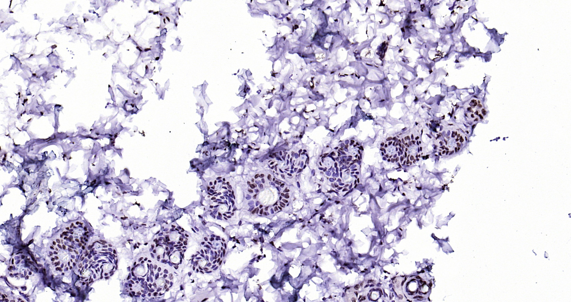 Paraformaldehyde-fixed, paraffin embedded Rat breast; Antigen retrieval by boiling in sodium citrate buffer (pH6.0) for 15min; Block endogenous peroxidase by 3% hydrogen peroxide for 20 minutes; Blocking buffer (normal goat serum) at 37°C for 30min; Antibody incubation with CIDEC Polyclonal Antibody, Unconjugated (bs-6796R) at 1:200 overnight at 4°C, DAB staining.