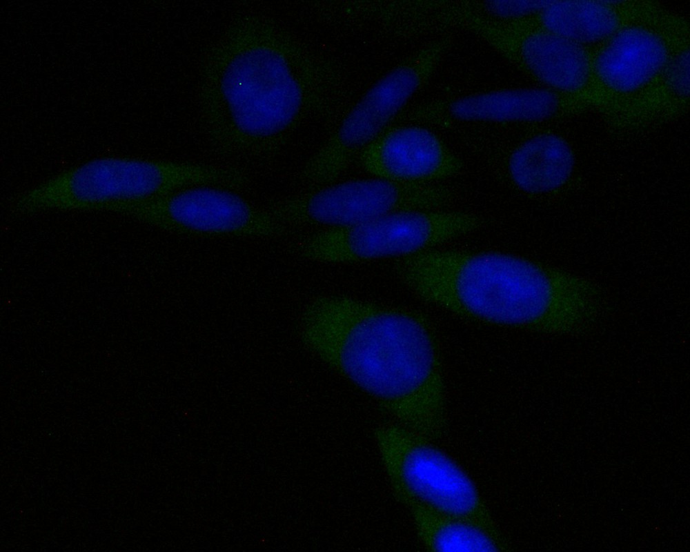 Hela cell; 4% Paraformaldehyde-fixed; Triton X-100 at room temperature for 20 min; Blocking buffer (normal goat serum) at 37°C for 20 min; Antibody incubation with (PSMA3) Monoclonal Antibody, Unconjugated (bsm-54696R) 1:50, 90 minutes at 37°C; followed by a conjugated Goat Anti-Rabbit IgG antibody at 37°C for 90 minutes, DAPI (blue) was used to stain the cell nuclei.