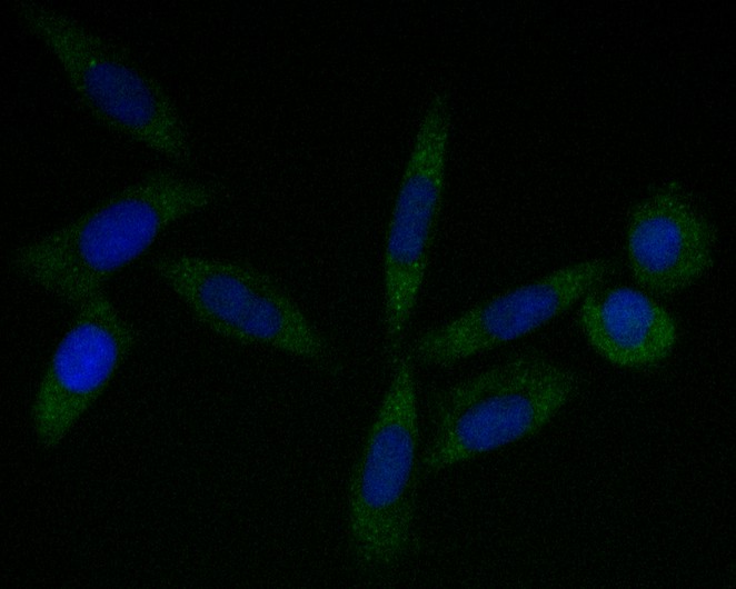 Siha cell; 4% Paraformaldehyde-fixed; Triton X-100 at room temperature for 20 min; Blocking buffer (normal goat serum) at 37°C for 20 min; Antibody incubation with (Tropomodulin 2) Monoclonal Antibody, Unconjugated (bsm-54701R) 1:100, 90 minutes at 37°C; followed by a conjugated Goat Anti-Rabbit IgG antibody at 37°C for 90 minutes, DAPI (blue) was used to stain the cell nuclei.