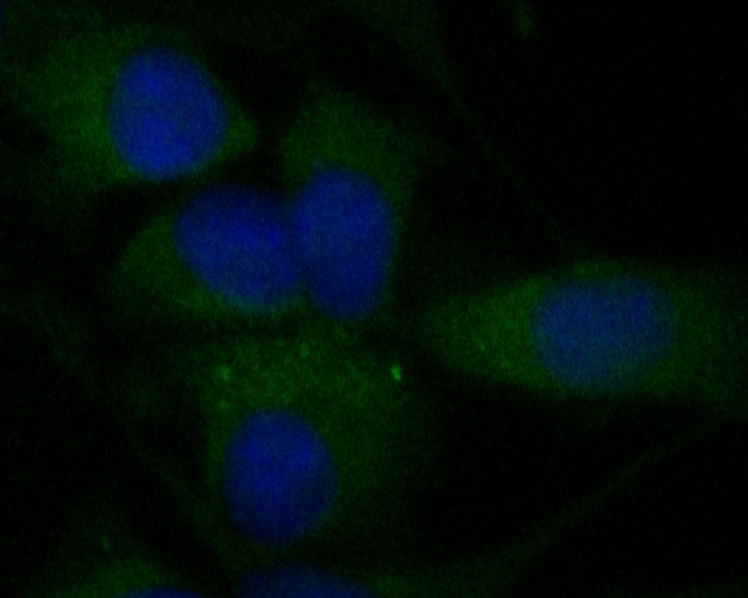 SHG-44 cell; 4% Paraformaldehyde-fixed; Triton X-100 at room temperature for 20 min; Blocking buffer (normal goat serum) at 37°C for 20 min; Antibody incubation with (KIFAP3) Monoclonal Antibody, Unconjugated (bsm-54702R) 1:50, 90 minutes at 37°C; followed by a conjugated Goat Anti-Rabbit IgG antibody at 37°C for 90 minutes, DAPI (blue) was used to stain the cell nuclei.