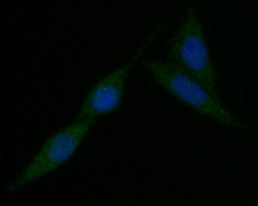 Siha cell; 4% Paraformaldehyde-fixed; Triton X-100 at room temperature for 20 min; Blocking buffer (normal goat serum) at 37°C for 20 min; Antibody incubation with (KIFAP3) Monoclonal Antibody, Unconjugated (bsm-54702R) 1:50, 90 minutes at 37°C; followed by a conjugated Goat Anti-Rabbit IgG antibody at 37°C for 90 minutes, DAPI (blue) was used to stain the cell nuclei.