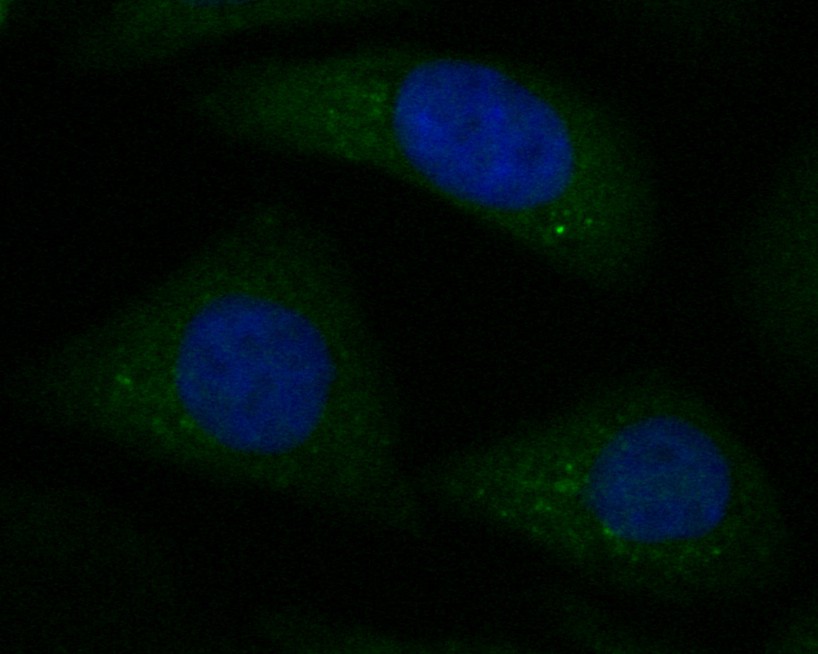 Hela cell; 4% Paraformaldehyde-fixed; Triton X-100 at room temperature for 20 min; Blocking buffer (normal goat serum) at 37°C for 20 min; Antibody incubation with (KIFAP3) Monoclonal Antibody, Unconjugated (bsm-54702R) 1:50, 90 minutes at 37°C; followed by a conjugated Goat Anti-Rabbit IgG antibody at 37°C for 90 minutes, DAPI (blue) was used to stain the cell nuclei.