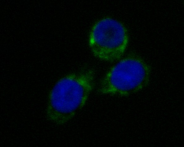 HT-29 cell; 4% Paraformaldehyde-fixed; Triton X-100 at room temperature for 20 min; Blocking buffer (normal goat serum) at 37°C for 20 min; Antibody incubation with (LDHD) Monoclonal Antibody, Unconjugated (bsm-54704R) 1:100, 90 minutes at 37°C;followed by a conjugated Goat Anti-Rabbit IgG antibody at 37°C for 90 minutes, DAPI (blue) was used to stain the cell nuclei.