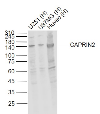Lane 1: Human U251 cell lysates; Lane 2: Human U87MG cell lysates; Lane 3: Human Huvec cell lysates probed with CAPRIN2 Polyclonal Antibody, Unconjugated (bs-12423R) at 1:1000 dilution and 4˚C overnight incubation. Followed by conjugated secondary antibody incubation at 1:20000 for 60 min at 37˚C.
