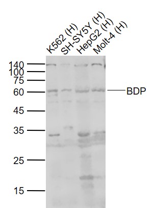Lane 1: Human K562 cell lysates; Lane 2: Human SH-SY5Y cell lysates; Lane 3: Human HepG2 cell lysates; Lane 4: Human Molt-4 cell lysates probed with BDP/ARID3B Polyclonal Antibody, Unconjugated (bs-12580R) at 1:1000 dilution and 4˚C overnight incubation. Followed by conjugated secondary antibody incubation at 1:20000 for 60 min at 37˚C.