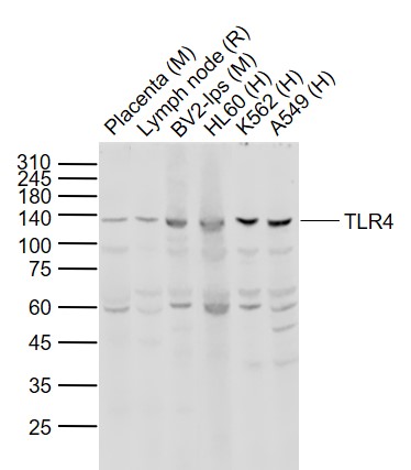 Lane 1: Mouse Placenta lysates; Lane 2: Rat Lymph node lysates; Lane 3: Mouse BV2-lps cell lysates; Lane 4: Human HL60 cell lysates ; Lane 5: Human K562 cell lysates ; Lane 6: Human A549 cell lysates probed with TLR4 Polyclonal Antibody, Unconjugated (bs-20594R) at 1:1000 dilution and 4˚C overnight incubation. Followed by conjugated secondary antibody incubation at 1:20000 for 60 min at 37˚C.
